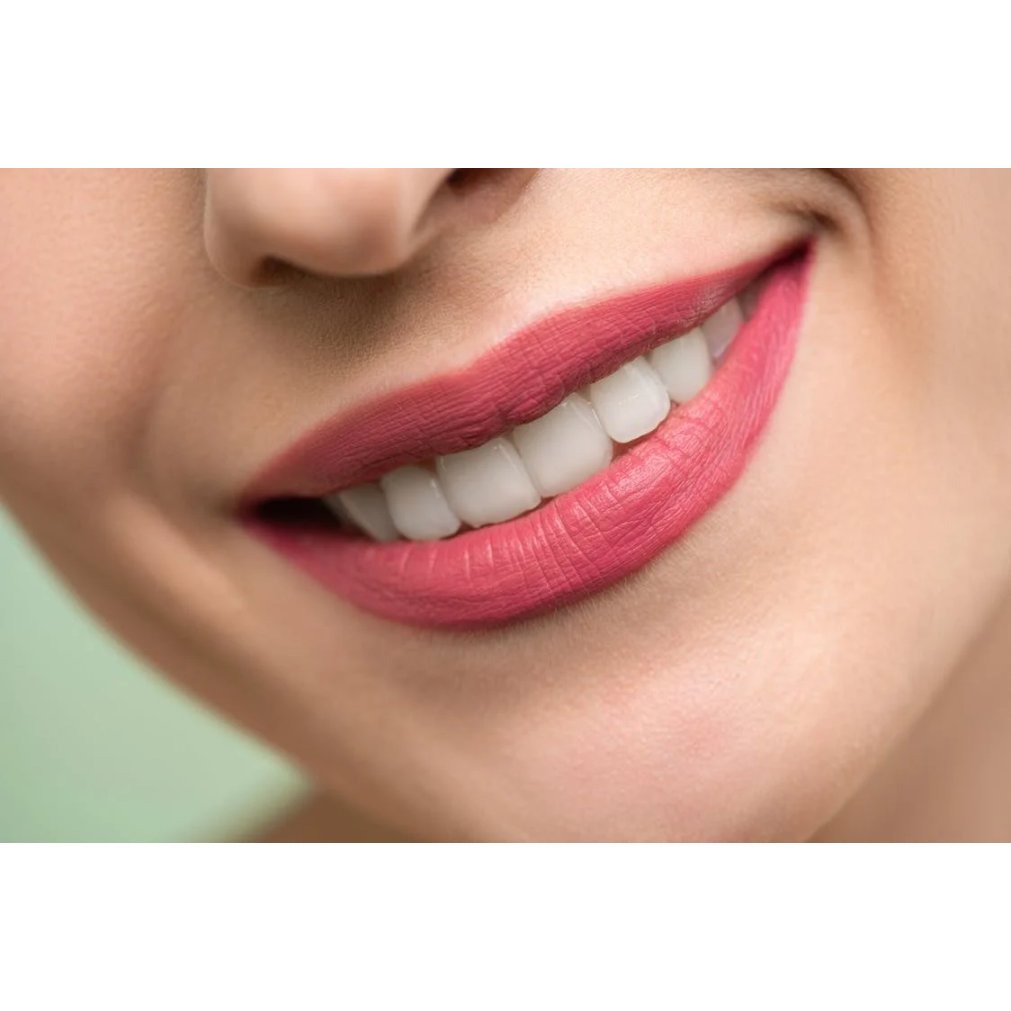What Are Comfort Covers for Braces? A Complete Guide